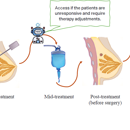 Graphic Neoadjuvant Breast Cancer